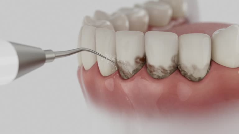 Trusted Teeth Cleaning And Checkup service in Lyford, TX - Dentist Open Now